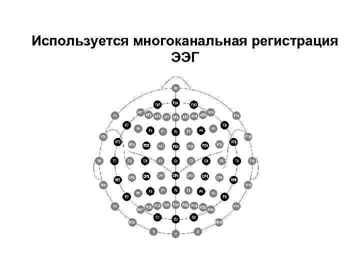 Используется многоканальная регистрация ЭЭГ 