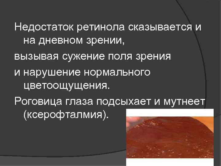 Недостаток ретинола сказывается и на дневном зрении, вызывая сужение поля зрения и нарушение нормального