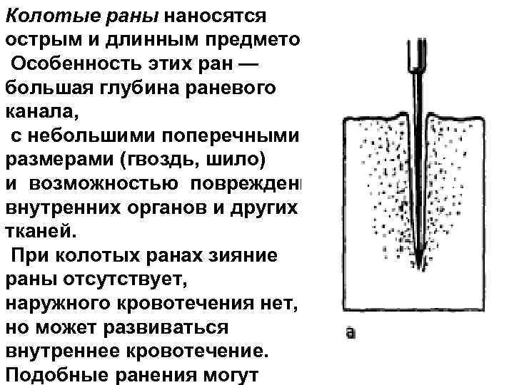 Ушибленная рана карта вызова