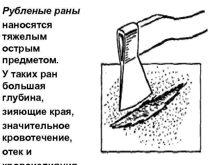 Как называется приспособление для натягивания ткани при вышивании изображенное на рисунке