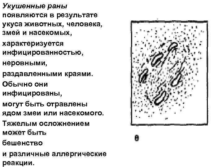 Укушенные раны появляются в результате укуса животных, человека, змей и насекомых, характеризуется инфицированностью, неровными,