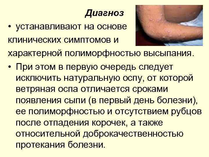Диагноз • устанавливают на основе клинических симптомов и характерной полиморфностью высыпания. • При этом