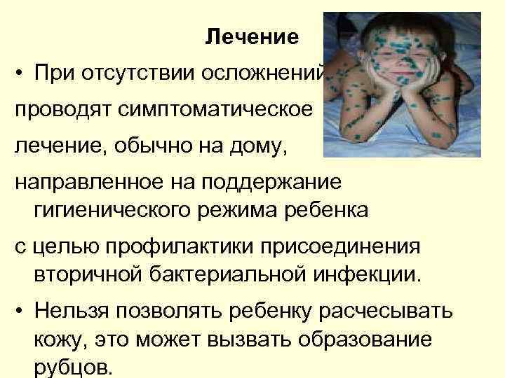 Лечение • При отсутствии осложнений проводят симптоматическое лечение, обычно на дому, направленное на поддержание