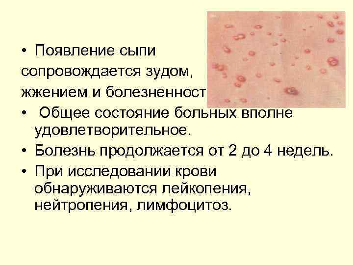  • Появление сыпи сопровождается зудом, жжением и болезненностью. • Общее состояние больных вполне