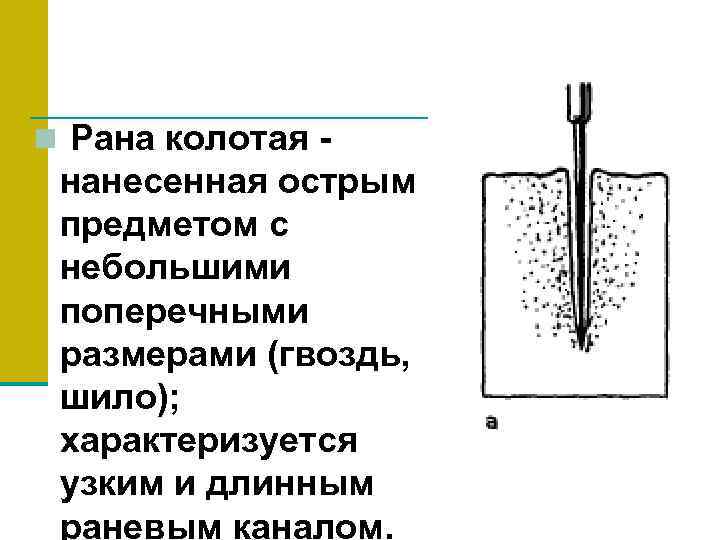 n Рана колотая - нанесенная острым предметом с небольшими поперечными размерами (гвоздь, шило); характеризуется