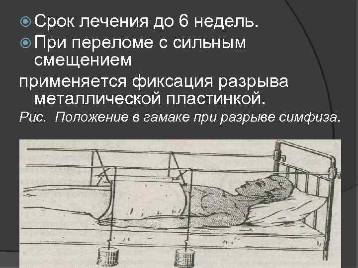  Срок лечения до 6 недель. При переломе с сильным смещением применяется фиксация разрыва