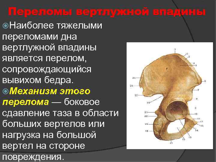 Перелом вертлужной впадины. Подвздошная кость крыша вертлужной впадины. Медиальная стенка вертлужной впадины. Анатомические образования вертлужной впадины. Дно вертлужной впадины.