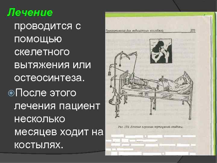 Лечение проводится с помощью скелетного вытяжения или остеосинтеза. После этого лечения пациент несколько месяцев