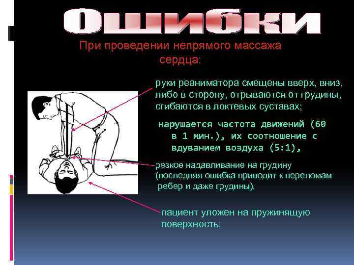 При проведении непрямого массажа сердца: руки реаниматора смещены вверх, вниз, либо в сторону, отрываются