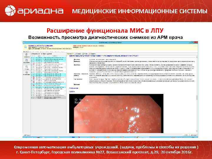 МЕДИЦИНСКИЕ ИНФОРМАЦИОННЫЕ СИСТЕМЫ Расширение функционала МИС в ЛПУ Возможность просмотра диагностических снимков из АРМ