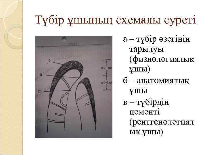 Түбір ұшының схемалы суреті а – түбір өзегінің тарылуы (физиологиялық ұшы) б – анатомиялық