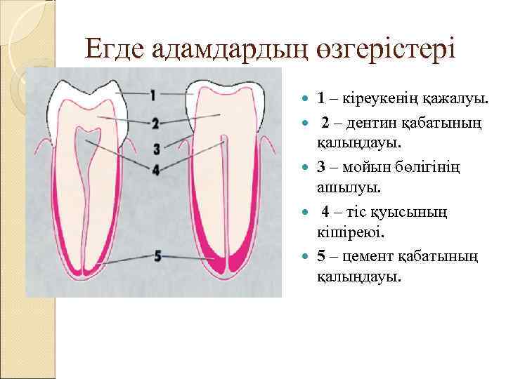 Егде адамдардың өзгерістері 1 – кіреукенің қажалуы. 2 – дентин қабатының қалыңдауы. 3 –