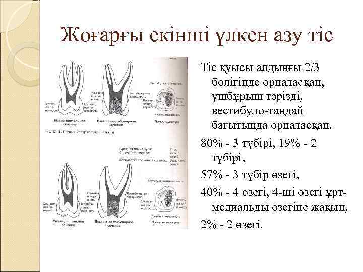 Жоғарғы екінші үлкен азу тіс Тіс қуысы алдыңғы 2/3 бөлігінде орналасқан, үшбұрыш тәрізді, вестибуло-таңдай