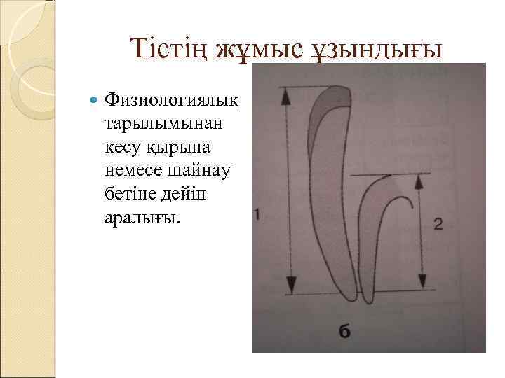 Тістің жұмыс ұзындығы Физиологиялық тарылымынан кесу қырына немесе шайнау бетіне дейін аралығы. 