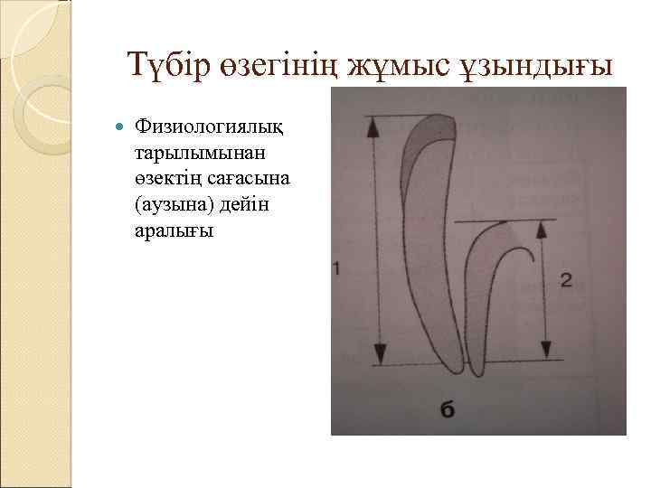 Түбір өзегінің жұмыс ұзындығы Физиологиялық тарылымынан өзектің сағасына (аузына) дейін аралығы 