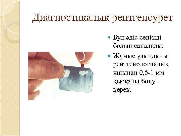 Диагностикалық рентгенсурет Бул әдіс сенімді болып саналады. Жұмыс ұзындығы рентгенологиялық ұшынан 0, 5 -1