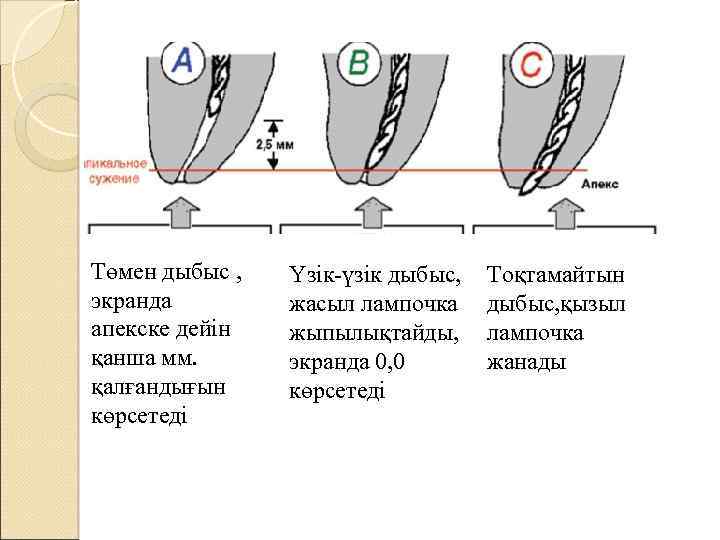 Төмен дыбыс , экранда апекске дейін қанша мм. қалғандығын көрсетеді Үзік-үзік дыбыс, жасыл лампочка