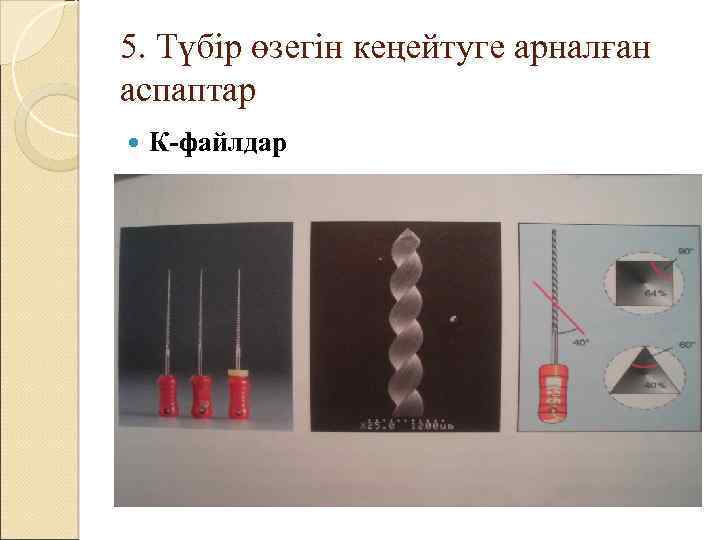 5. Түбір өзегін кеңейтуге арналған аспаптар К-файлдар 