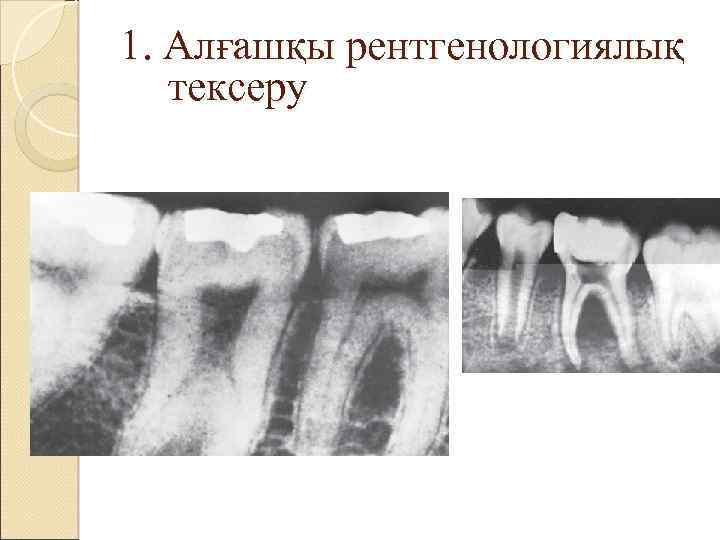 1. Алғашқы рентгенологиялық тексеру 