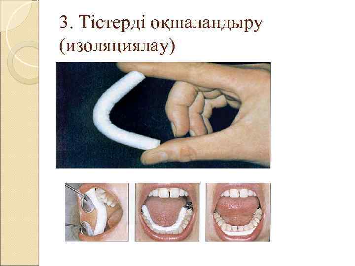 3. Тістерді оқшаландыру (изоляциялау) 