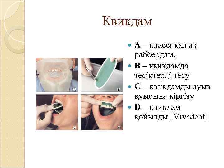 Квикдам А – классикалық раббердам, В – квикдамда тесіктерді тесу С – квикдамды ауыз