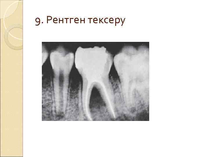 9. Рентген тексеру 