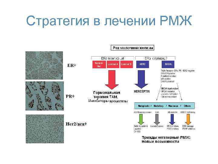 Стратегия в лечении РМЖ 