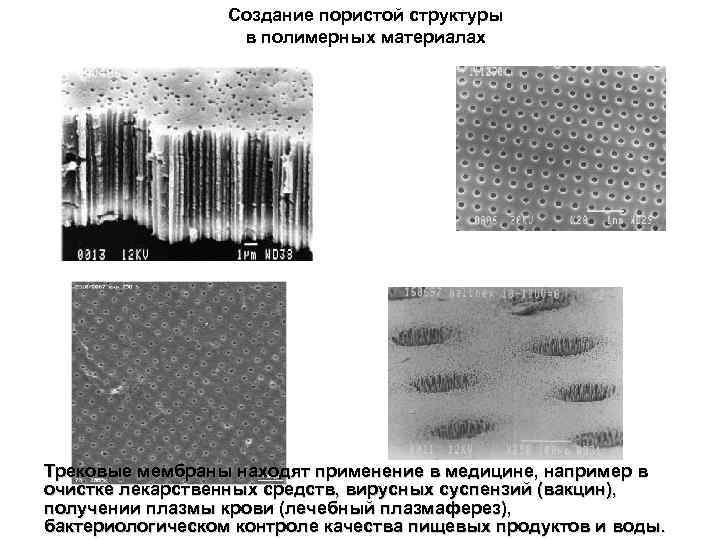 Создание пористой структуры в полимерных материалах Трековые мембраны находят применение в медицине, например в