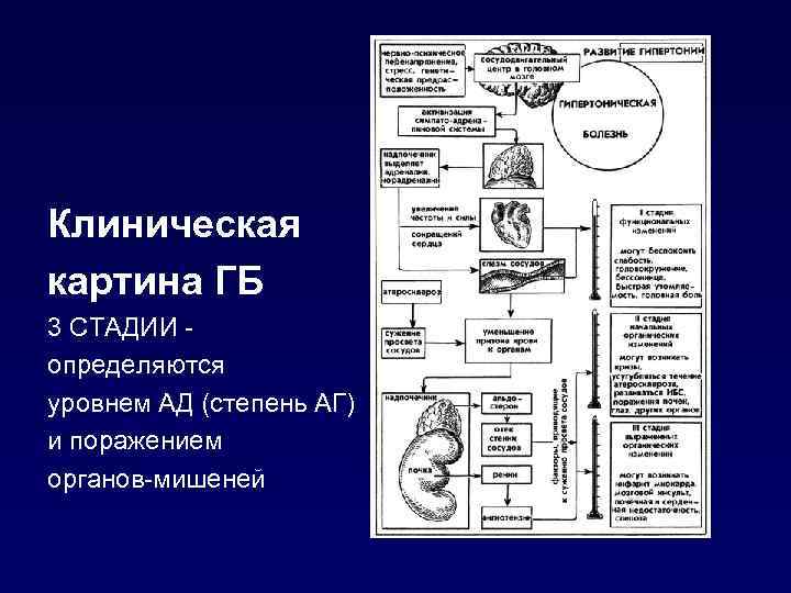 Клиническая картина ГБ 3 СТАДИИ определяются уровнем АД (степень АГ) и поражением органов-мишеней 