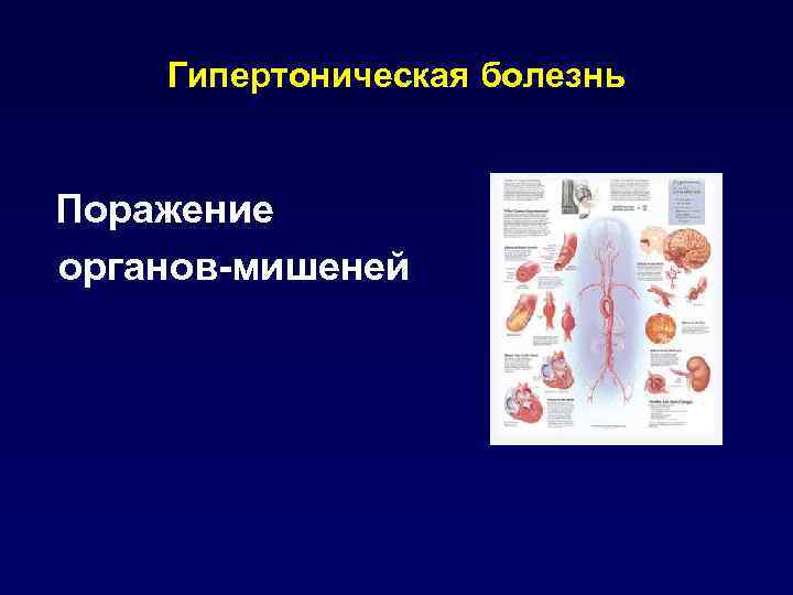 Гипертоническая болезнь Поражение органов-мишеней 