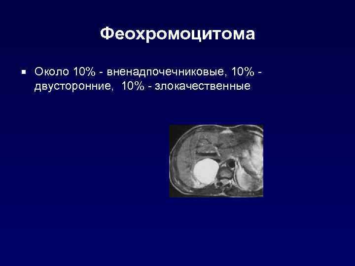 Феохромоцитома ¡ Около 10% - вненадпочечниковые, 10% - двусторонние, 10% - злокачественные 