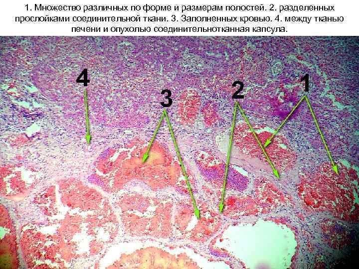 1. Множество различных по форме и размерам полостей. 2. разделенных прослойками соединительной ткани. 3.