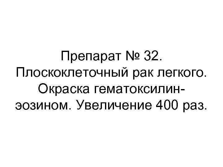 Препарат № 32. Плоскоклеточный рак легкого. Окраска гематоксилинэозином. Увеличение 400 раз. 