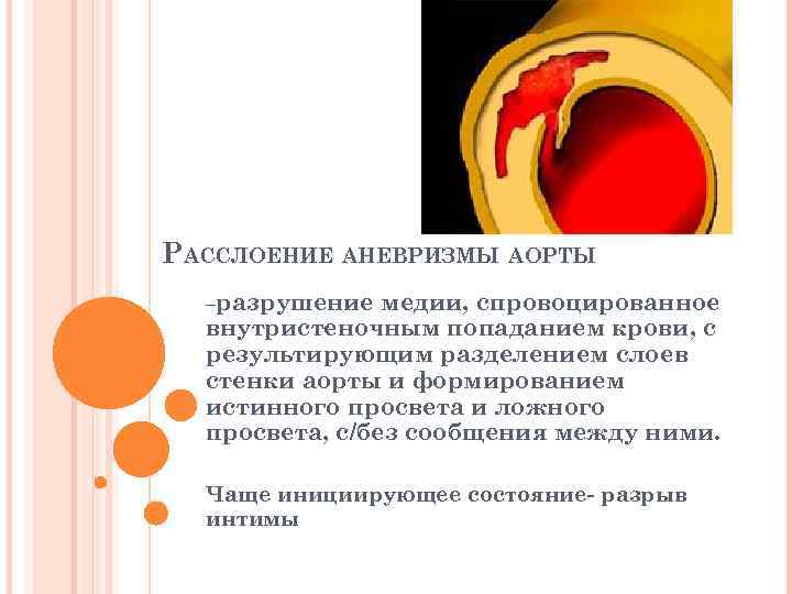 РАССЛОЕНИЕ АНЕВРИЗМЫ АОРТЫ –разрушение медии, спровоцированное внутристеночным попаданием крови, с результирующим разделением слоев стенки