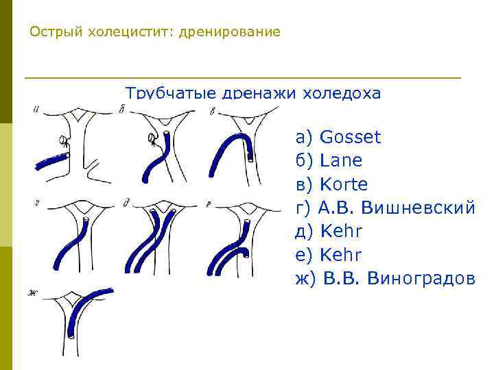 Острый холецистит тесты с ответами