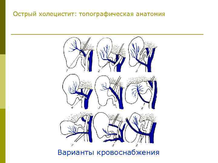 Острый холецистит: топографическая анатомия Варианты кровоснабжения 