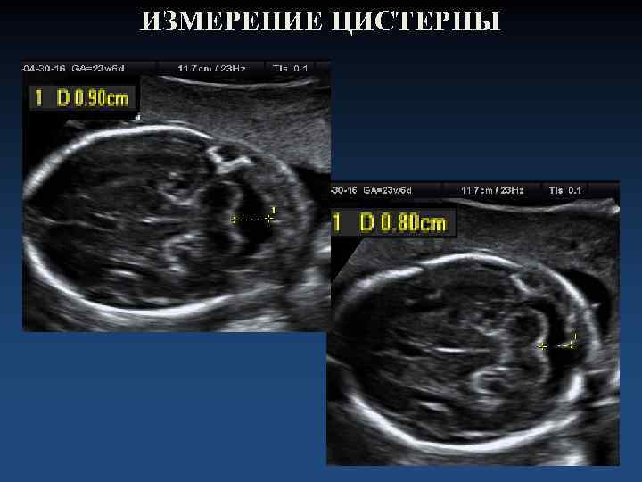 ИЗМЕРЕНИЕ ЦИСТЕРНЫ 