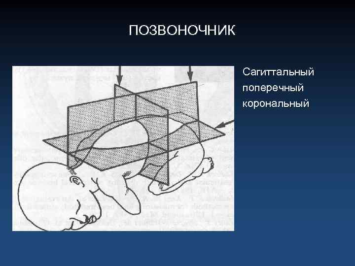 ПОЗВОНОЧНИК Сагиттальный поперечный корональный 