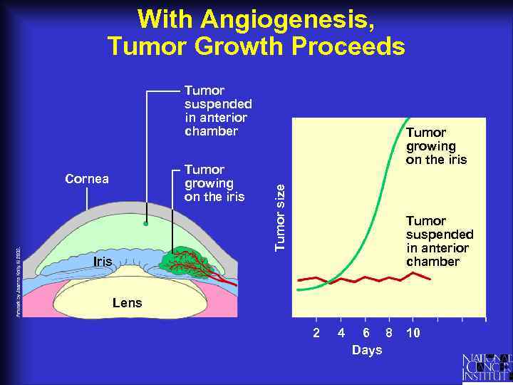 With Angiogenesis, Tumor Growth Proceeds Tumor suspended in anterior chamber Cornea Tumor size Tumor