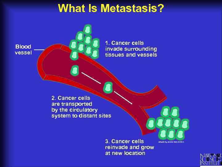 What Is Metastasis? Blood vessel 1. Cancer cells invade surrounding tissues and vessels 2.