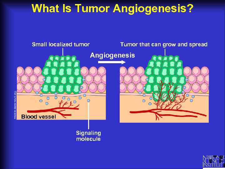 What Is Tumor Angiogenesis? Small localized tumor Tumor that can grow and spread Angiogenesis