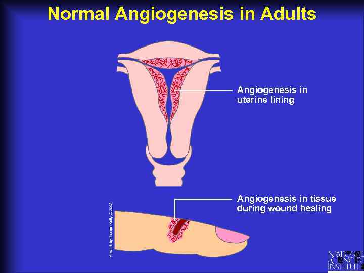 Normal Angiogenesis in Adults Angiogenesis in uterine lining Angiogenesis in tissue during wound healing