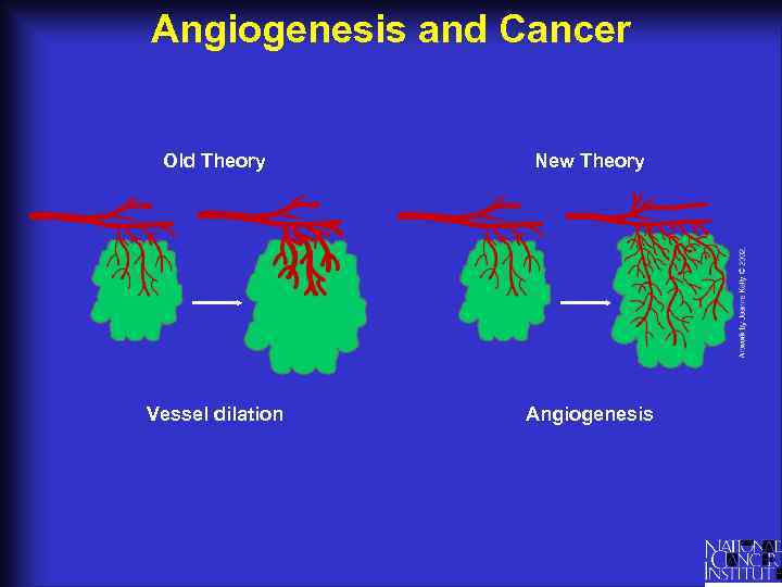 Angiogenesis and Cancer Old Theory New Theory Vessel dilation Angiogenesis 