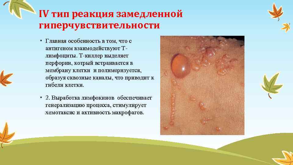 IV тип реакция замедленной гиперчувствительности • Главная особенность в том, что с антигеном взаимодействуют