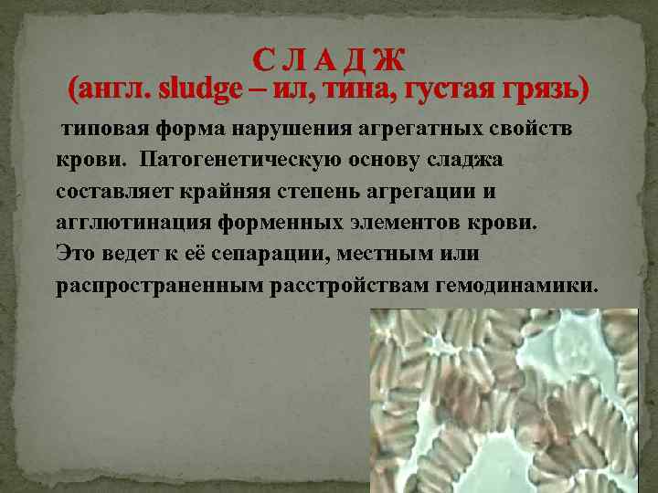 СЛАДЖ (англ. sludge – ил, тина, густая грязь) типовая форма нарушения агрегатных свойств крови.