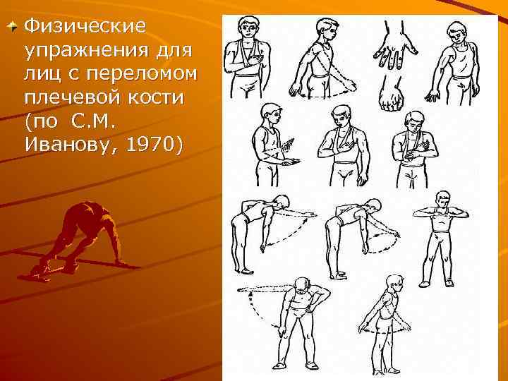 Физические упражнения для лиц с переломом плечевой кости (по С. М. Иванову, 1970) 