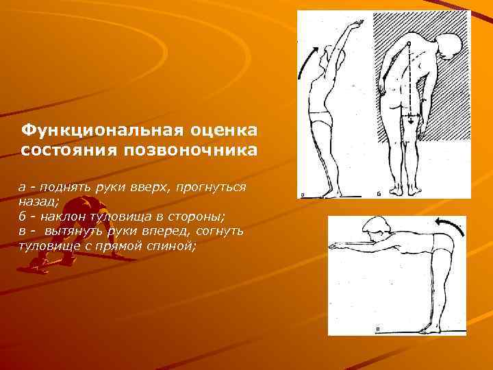 Функциональная оценка состояния позвоночника а - поднять руки вверх, прогнуться назад; б - наклон