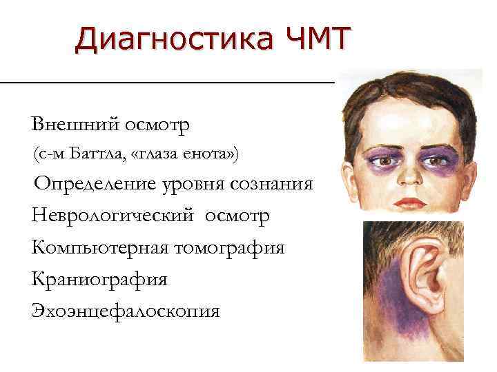 Диагностика ЧМТ Внешний осмотр (с-м Баттла, «глаза енота» ) Определение уровня сознания Неврологический осмотр
