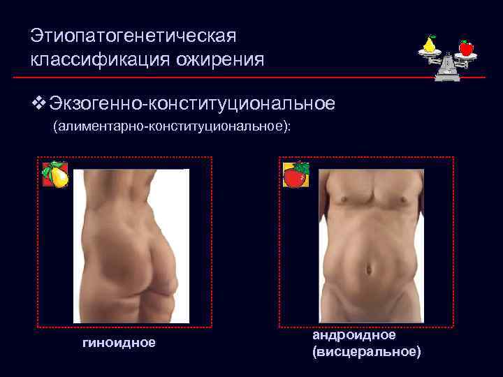 Этиопатогенетическая классификация ожирения v Экзогенно-конституциональное (алиментарно-конституциональное): гиноидное андроидное (висцеральное) 