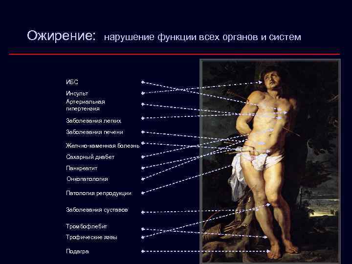 Ожирение: нарушение функции всех органов и систем ИБС Инсульт Артериальная гипертензия Заболевания легких Заболевания